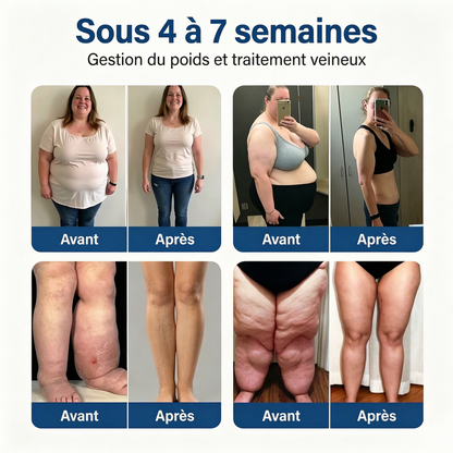 Florisma® Patch Gestion du Poids & Traitement Veineux 👩‍⚕️ Une seule fois par jour : des résultats en 7 jours 🏆 Favorise la perte de poids et soulage les varices, les varicosités ainsi que les jambes lourdes et fatiguées.
