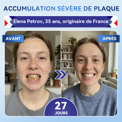 🎁Sourire instantané 🎁 𝐺𝑙𝑖𝑚𝑚𝑒𝑟𝑙𝑦® Tideglusib Dents et gencives Bandes orales réparatrices à dissolution rapide 💎 (Restaure émail/dentine • Renforce gencives • Élimine tartre & odeurs • Blanchit • Fin des sensibilités)