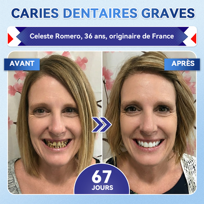 🎁Sourire instantané 🎁 𝐺𝑙𝑖𝑚𝑚𝑒𝑟𝑙𝑦® Tideglusib Dents et gencives Bandes orales réparatrices à dissolution rapide 💎 (Restaure émail/dentine • Renforce gencives • Élimine tartre & odeurs • Blanchit • Fin des sensibilités)