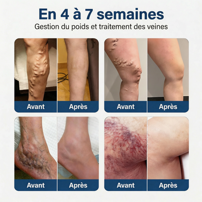 Florisma® Patch Gestion du Poids & Traitement Veineux 👩‍⚕️ Une seule fois par jour : des résultats en 7 jours 🏆 Favorise la perte de poids et soulage les varices, les varicosités ainsi que les jambes lourdes et fatiguées.
