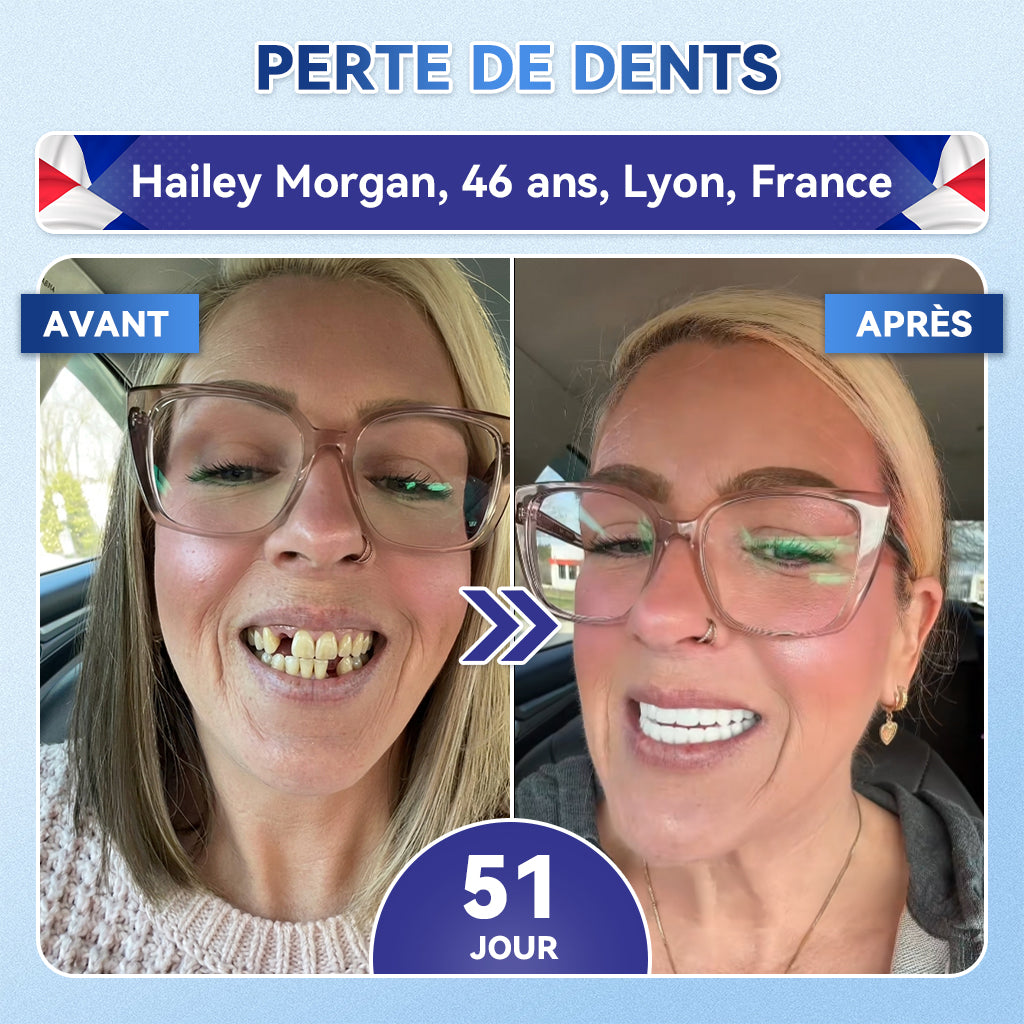 🎁Sourire instantané 🎁 𝐺𝑙𝑖𝑚𝑚𝑒𝑟𝑙𝑦® Tideglusib Dents et gencives Bandes orales réparatrices à dissolution rapide 💎 (Restaure émail/dentine • Renforce gencives • Élimine tartre & odeurs • Blanchit • Fin des sensibilités)