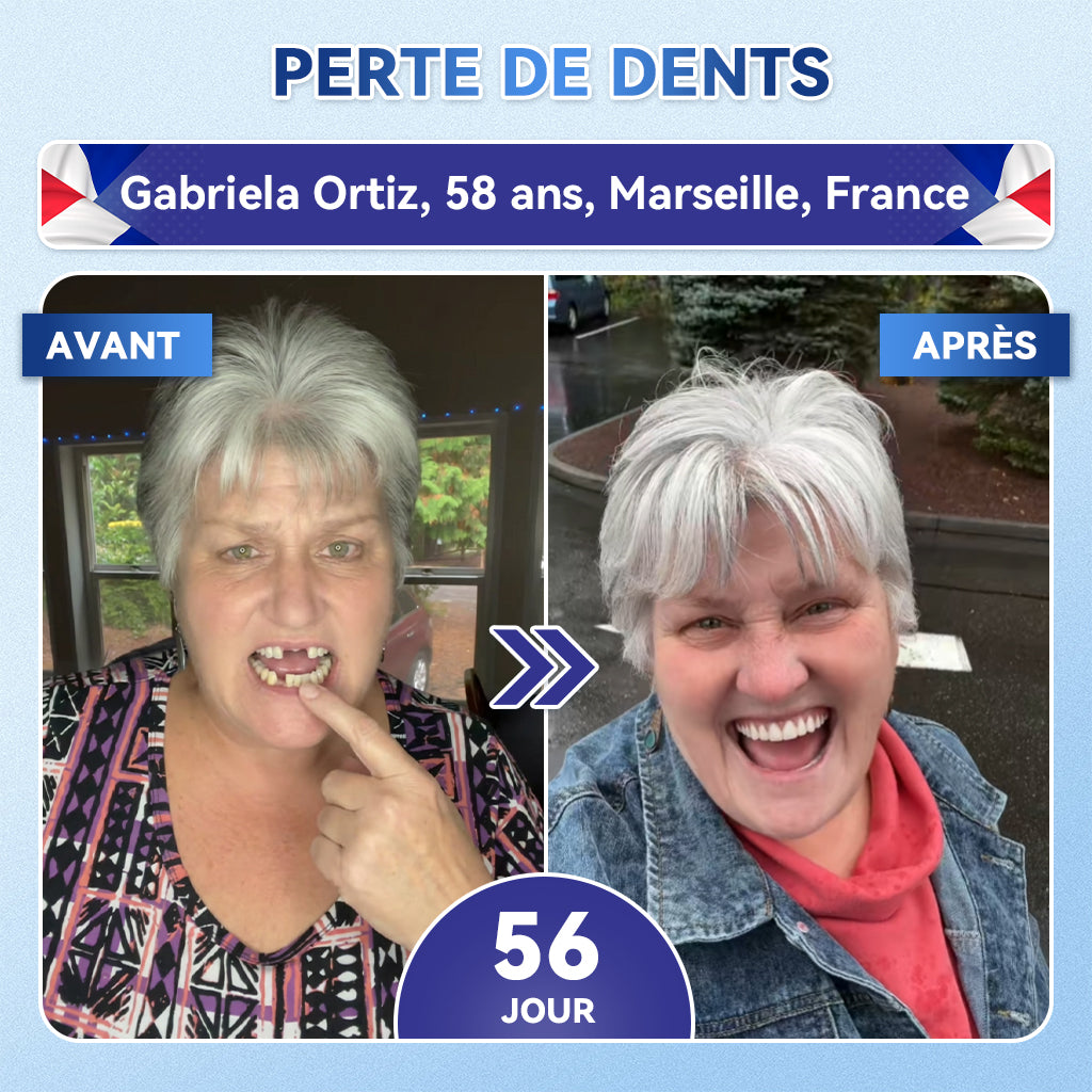 🎁Sourire instantané 🎁 𝐺𝑙𝑖𝑚𝑚𝑒𝑟𝑙𝑦® Tideglusib Dents et gencives Bandes orales réparatrices à dissolution rapide 💎 (Restaure émail/dentine • Renforce gencives • Élimine tartre & odeurs • Blanchit • Fin des sensibilités)